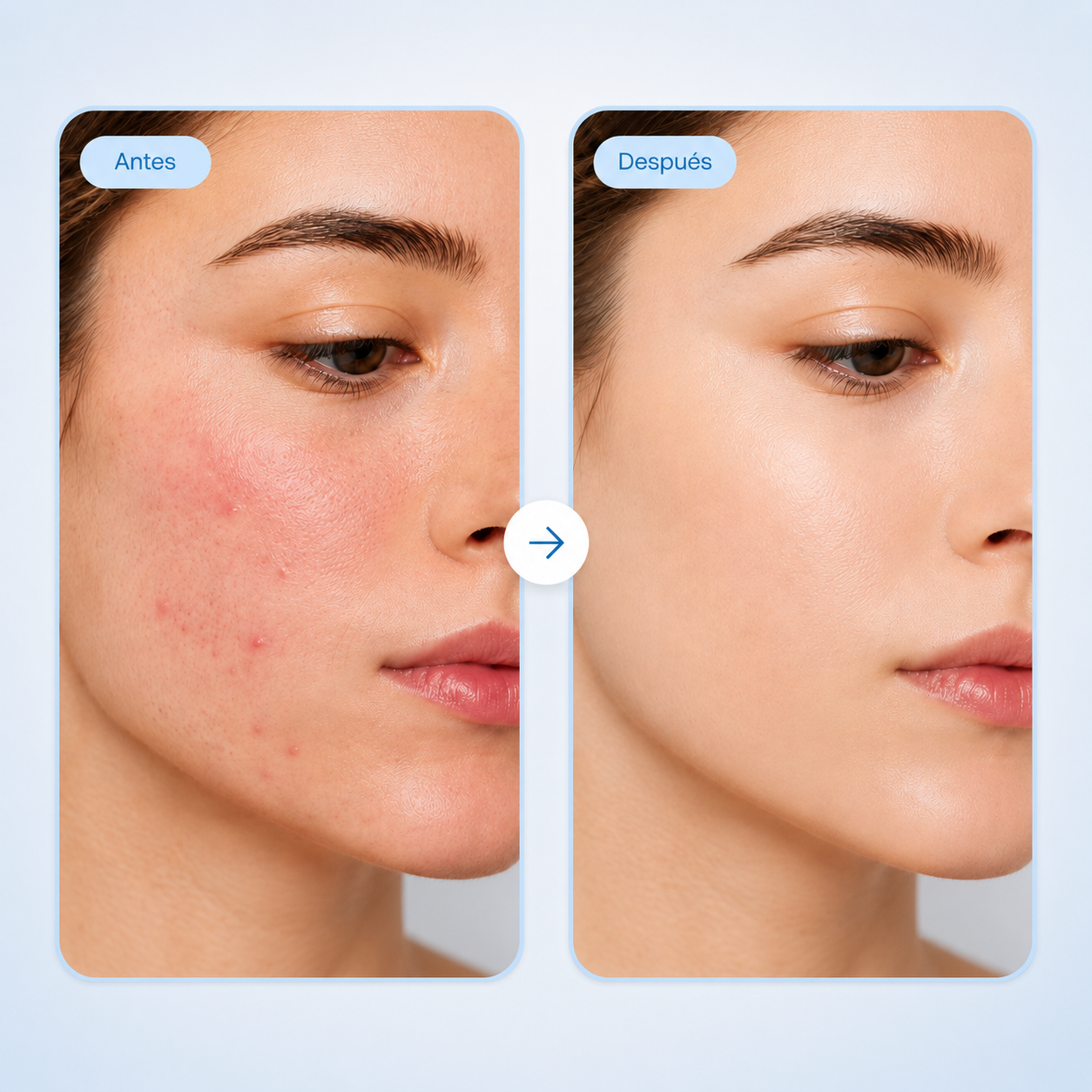 Toallitas Faciales Vakora (50 + 50 Gratis)