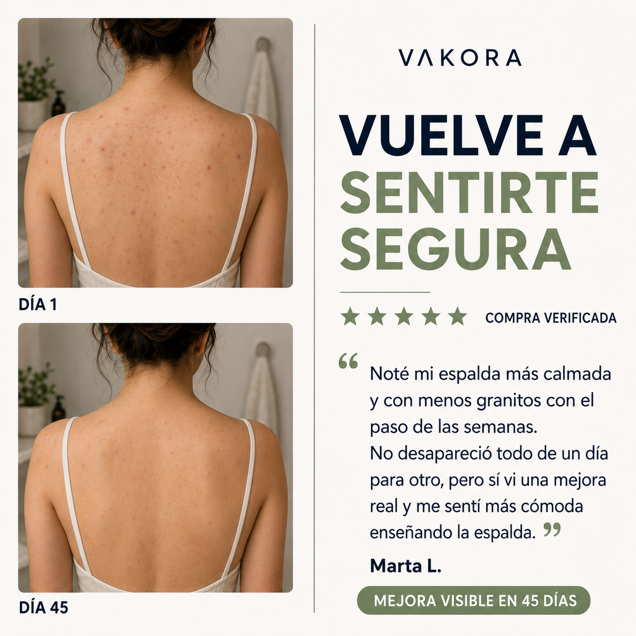 Jabón Antiacné Vakora 1 + 1 Gratis