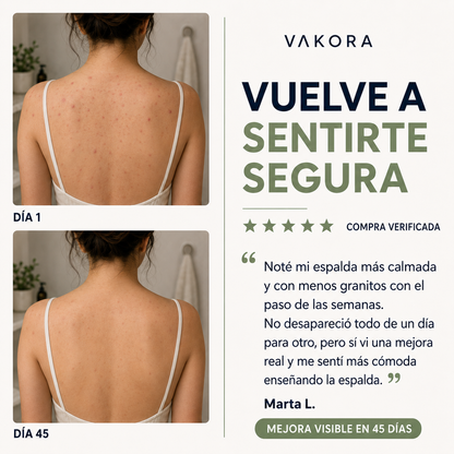 Jabón Antiacné Vakora 1 + 1 Gratis