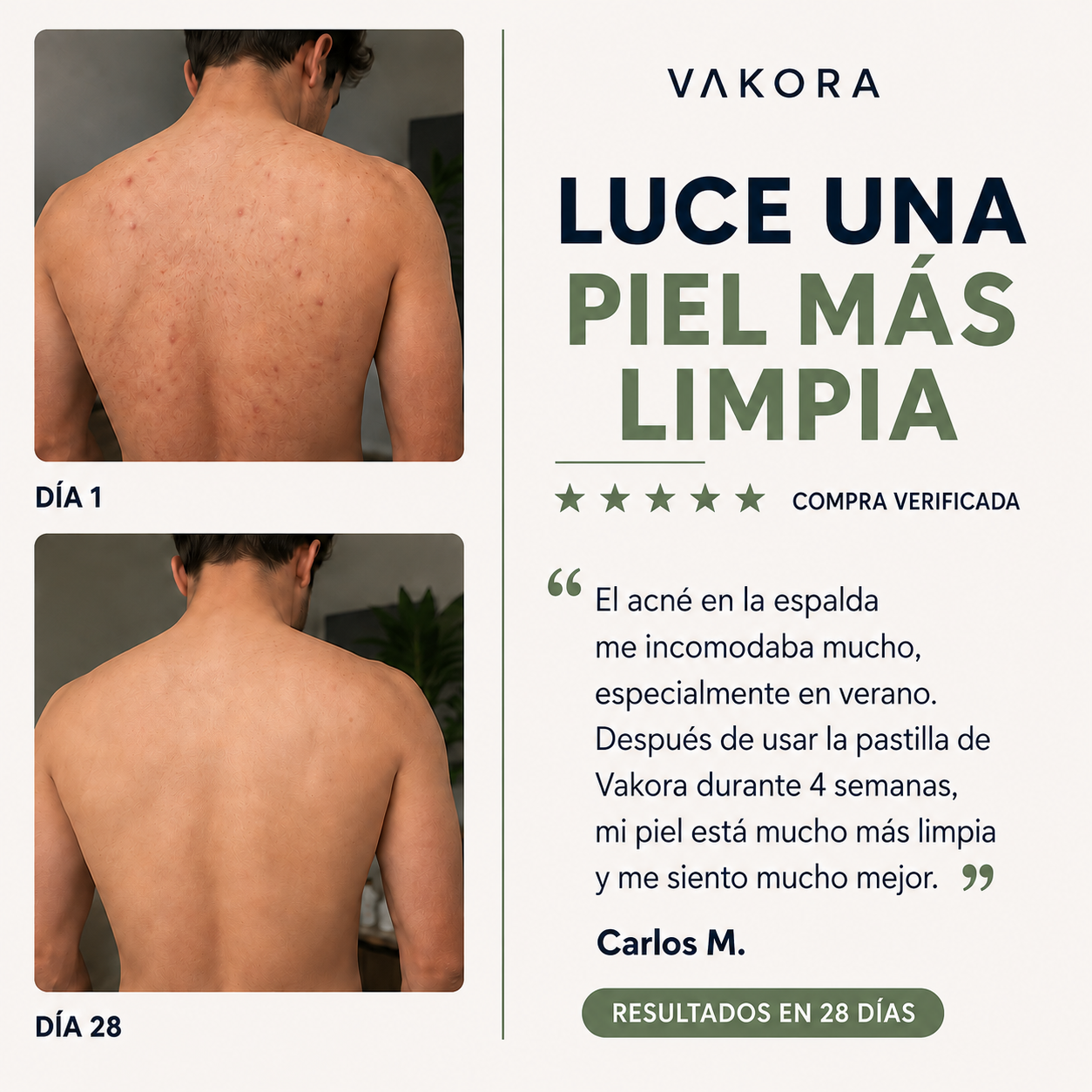 Jabón Antiacné Vakora 1 + 1 Gratis